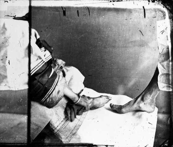 John Thomson Collection photo